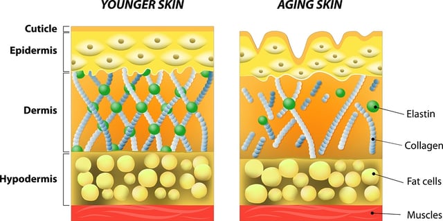 bigstock-younger-skin-and-older-skin-77343413.jpg